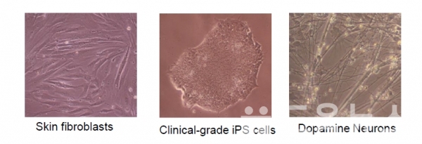 그림 2. 피부세포, 유도만능 줄기세포, 도파민 뉴런의 사진