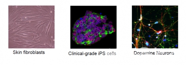 그림 3. 피부세포, 유도만능 줄기세포, 도파민 뉴런의 사진